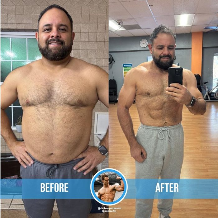 Rafael F. before and after